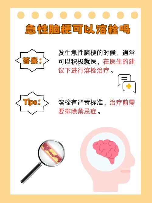 脑梗导致脑鸣可以支架吗