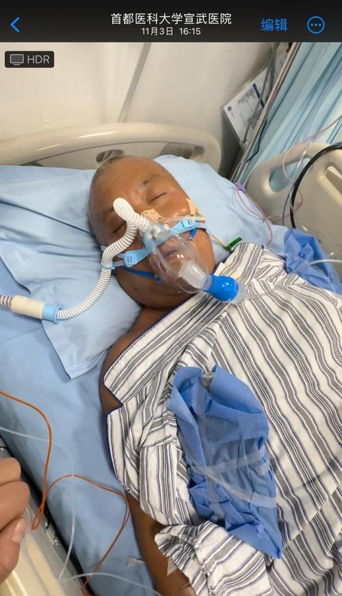 心梗服药半年后发生脑梗