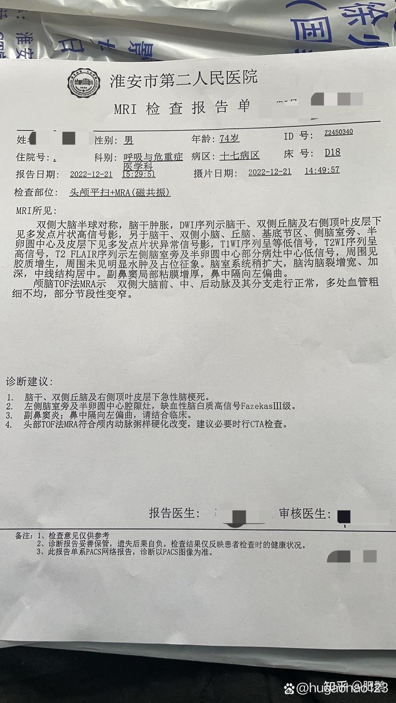 脑梗需要检查torch