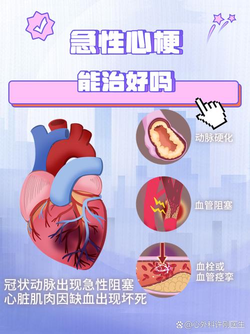 怎么判断是心梗还是脑梗