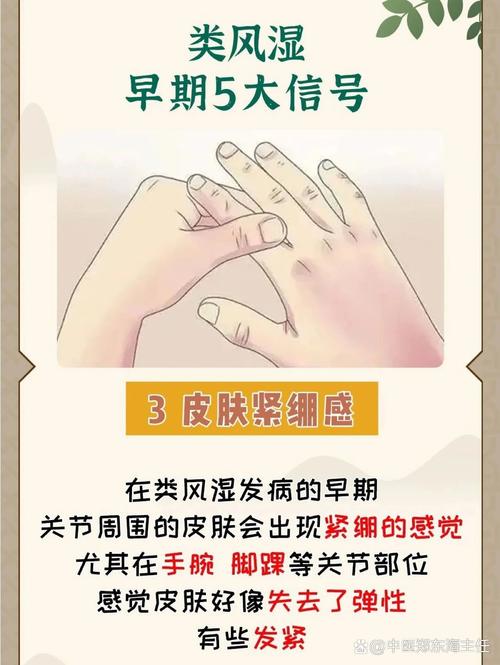 肾病风湿科是不是风湿科