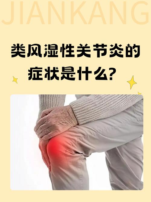 风湿类风湿症状全身无力