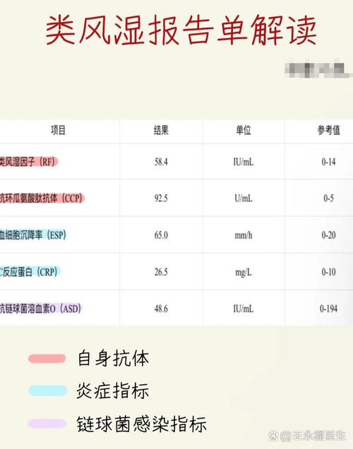 类风湿因子正常是风湿吗