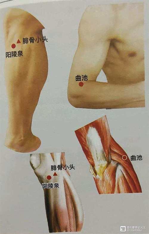 下肢水肿针灸哪些穴位