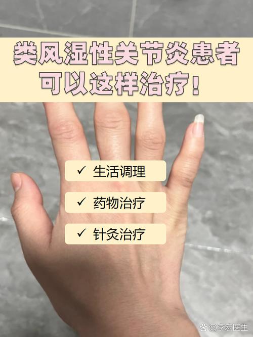 风湿会不会误诊为类风湿