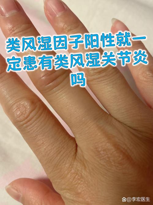 未检测出风湿因子的风湿