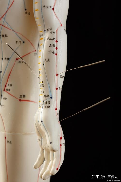 胳膊某个穴位突然酸痛