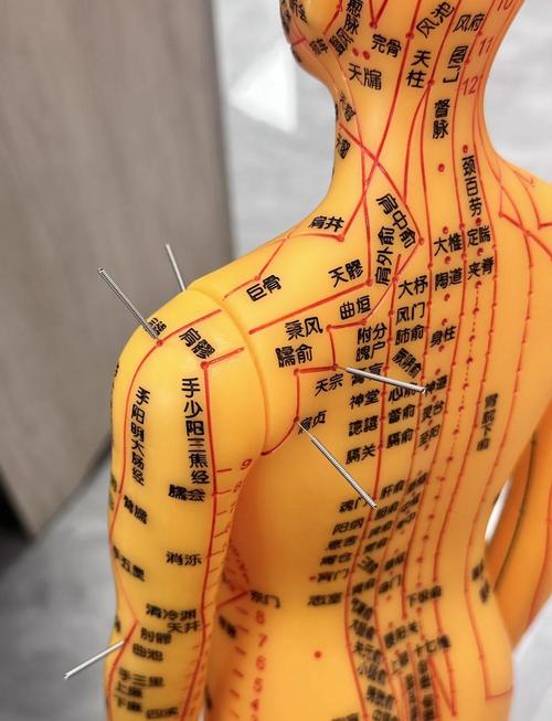 肩膀疼痛穴位治疗方法