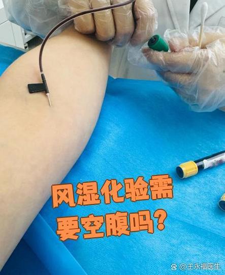 检查风湿类风湿用空腹吗