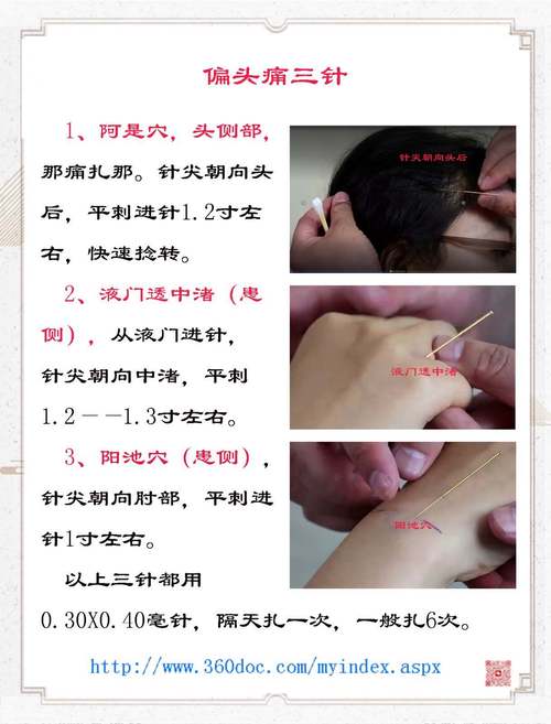 头部哪些穴位不能针灸