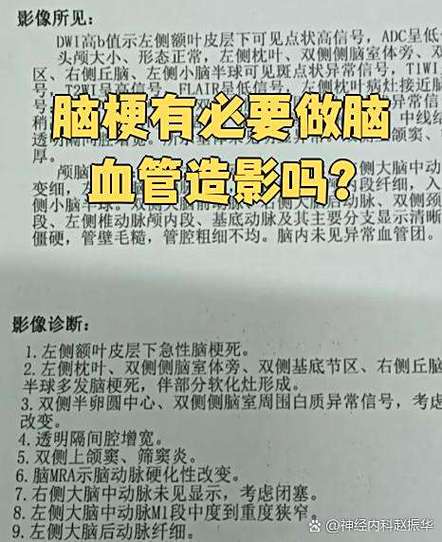 脑梗做脑造影需要买什么