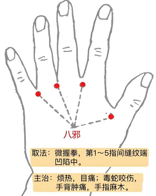 银针针刺哪些穴位止痒