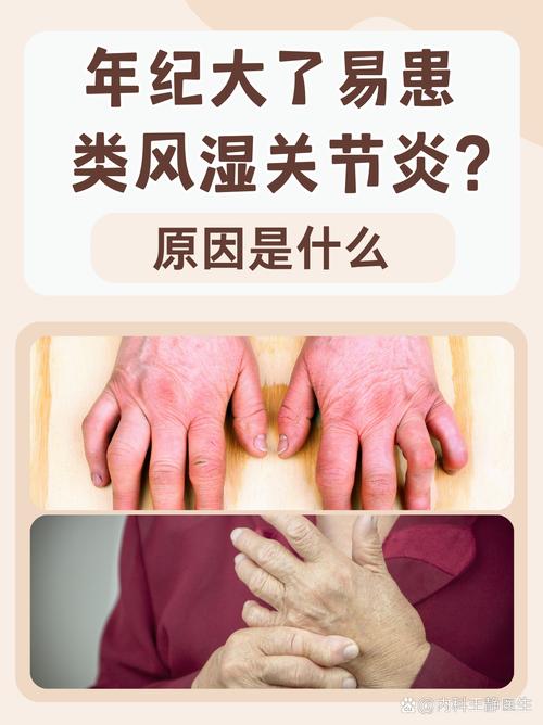 产后风湿类风湿因子高吗