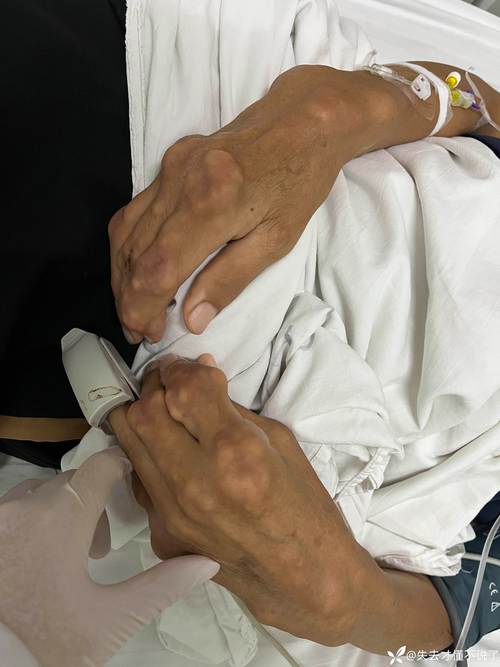 超敏c是风湿还是类风湿