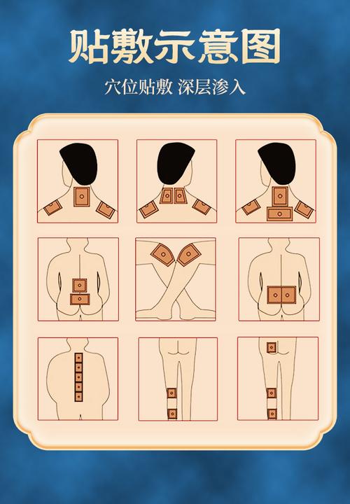 穴位敷贴属于什么范围