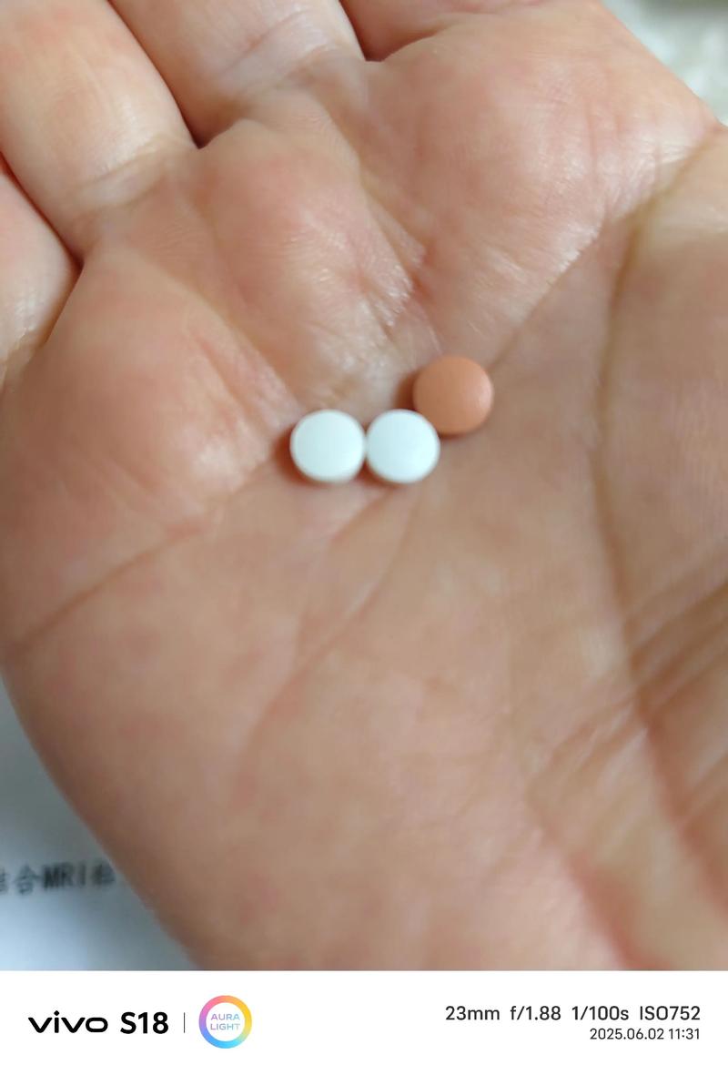 脑梗 脑ct查什么科室