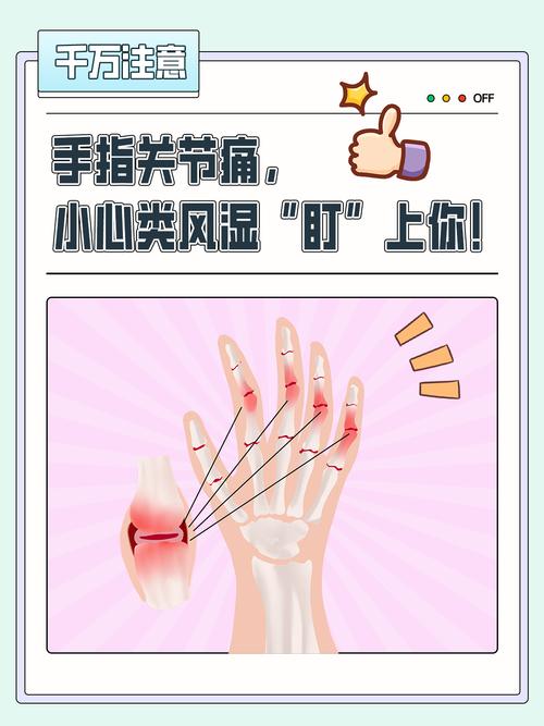 内风湿和外风湿怎么检查