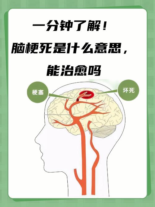 原发性脑梗和多发性脑梗