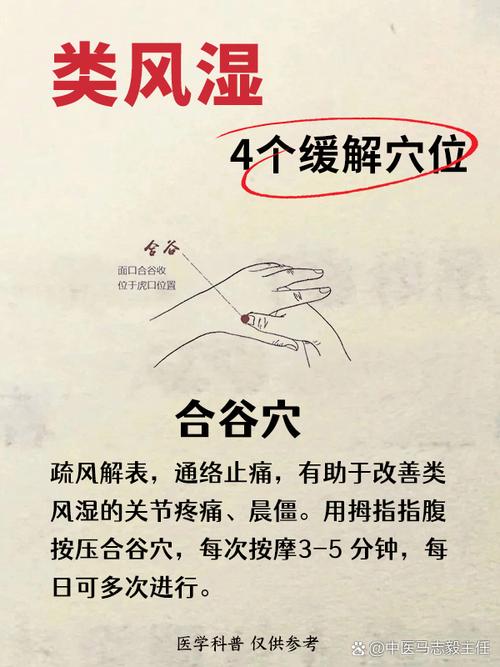 风湿类风湿需要去哪治疗