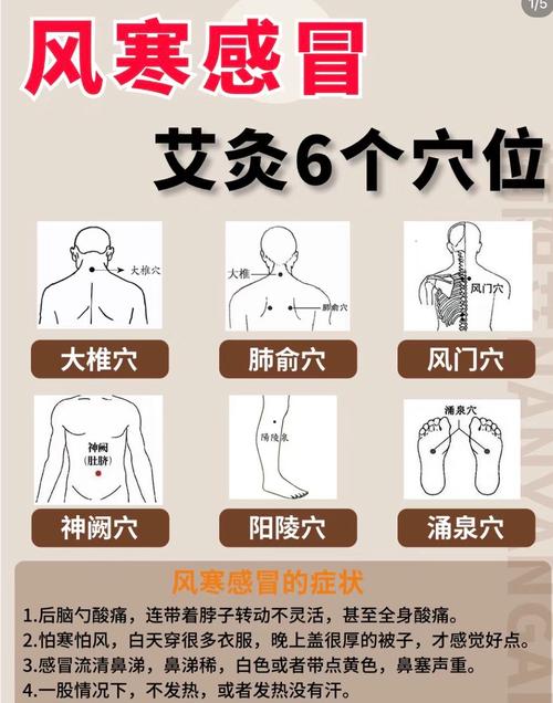 风寒感冒针灸哪个穴位