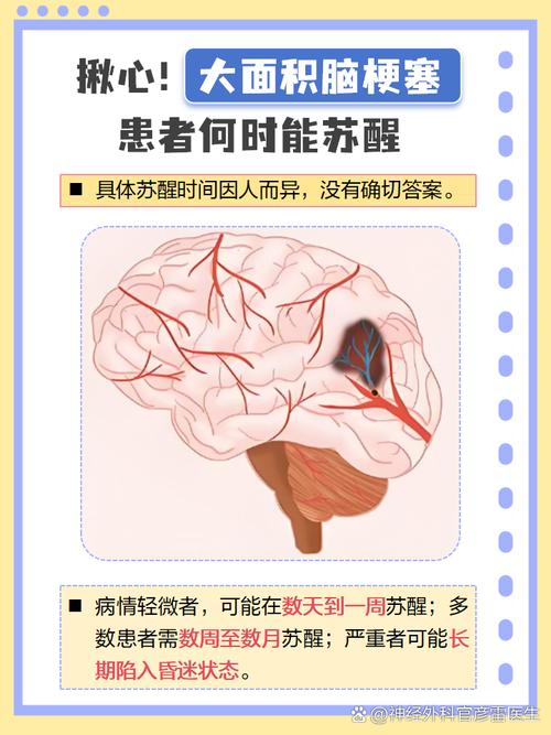 脑梗面积大算轻度脑梗吗