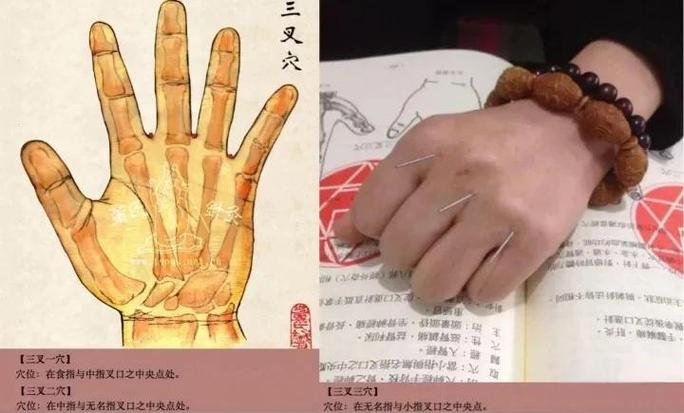 药物依赖针灸什么穴位