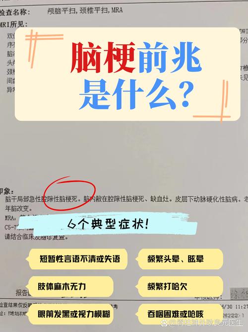 脑梗前兆后多久发生脑梗