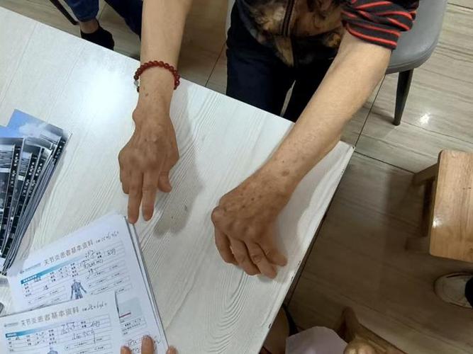 风湿和类风湿做什么检查