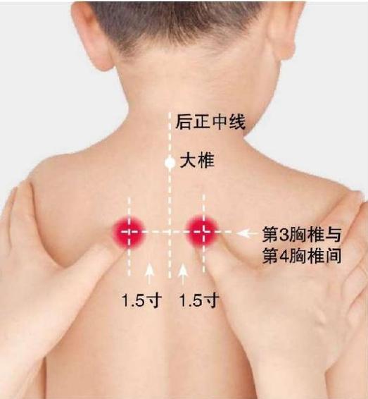 宝宝咳嗽艾灸哪些穴位
