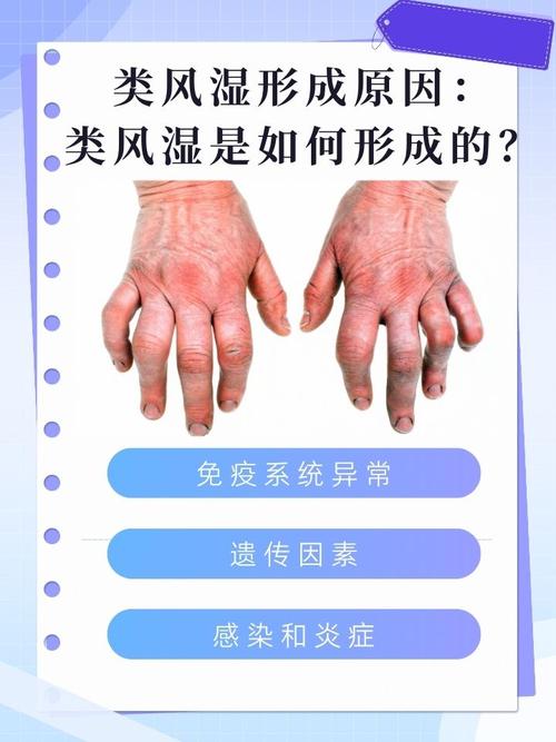 风湿科跟血液风湿科什么