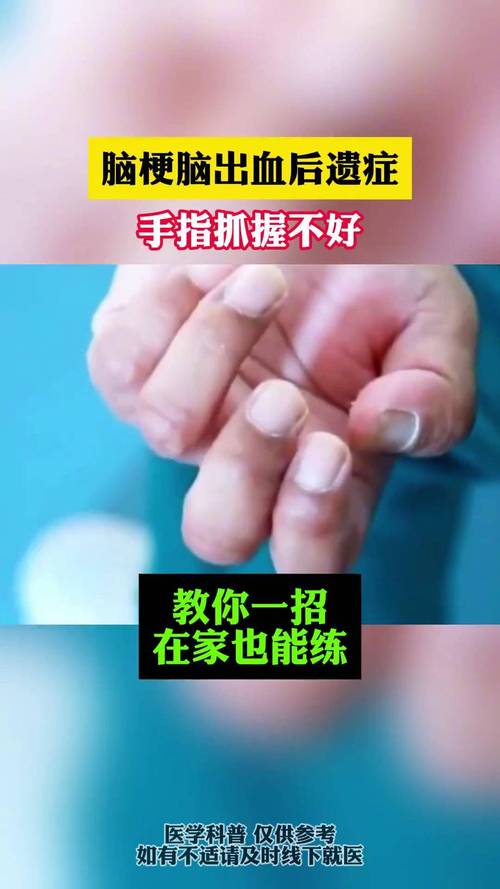 脑梗偏瘫的康复训练方法