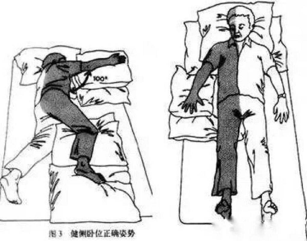 脑梗偏瘫的康复训练方法