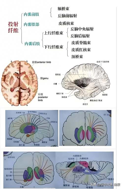 双侧基底节区腔隙性脑梗