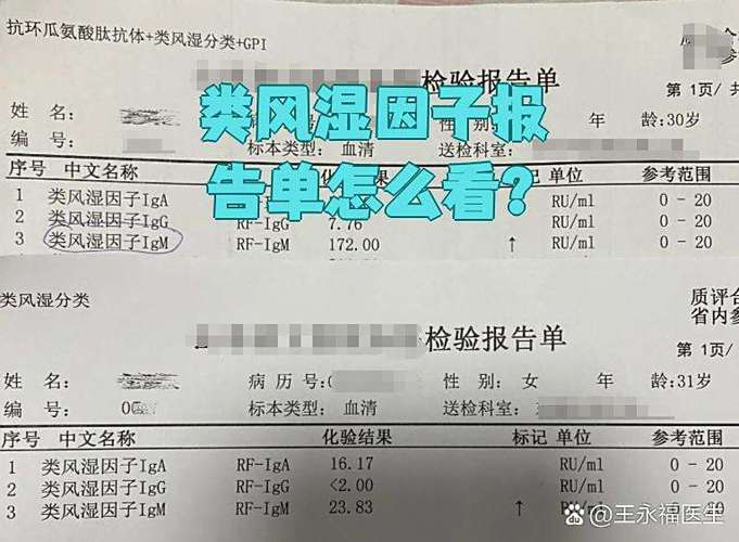 类风湿类风湿因子217