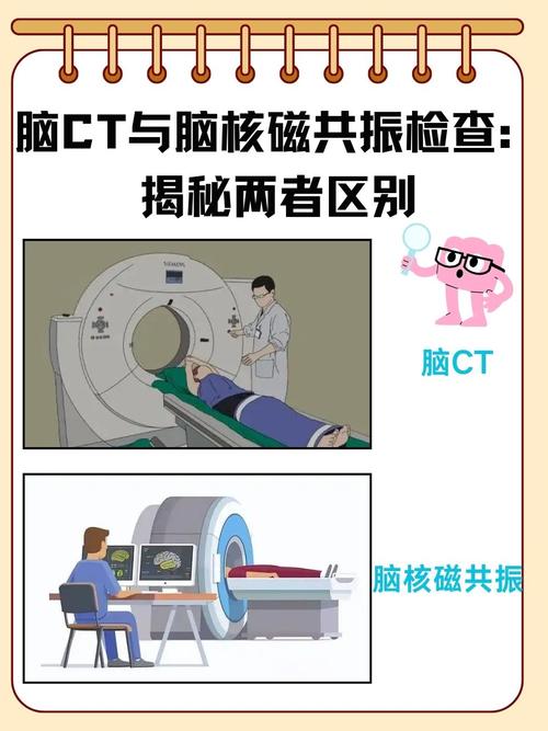 轻微脑梗做ct还是核磁