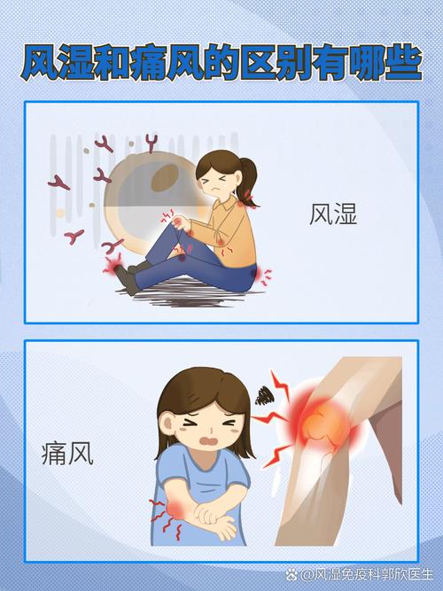 类风湿和风湿 哪个严重