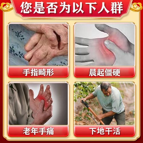 风湿类风湿全身骨节变形