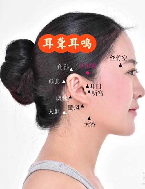耳鸣耳聋针灸哪些穴位