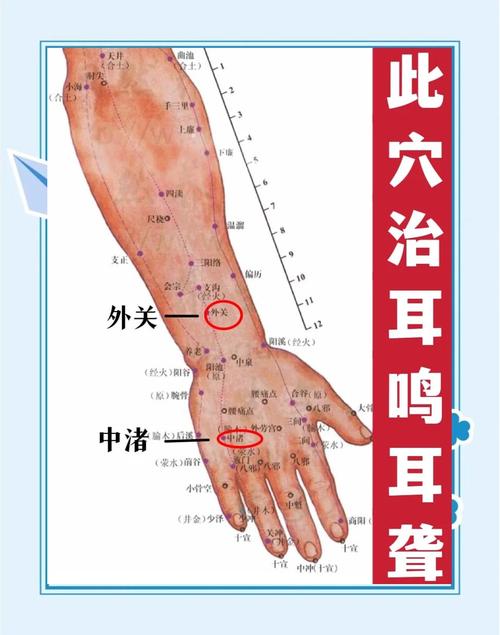 耳鸣耳聋针灸哪些穴位