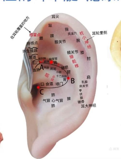 睡眠不好耳针哪些穴位