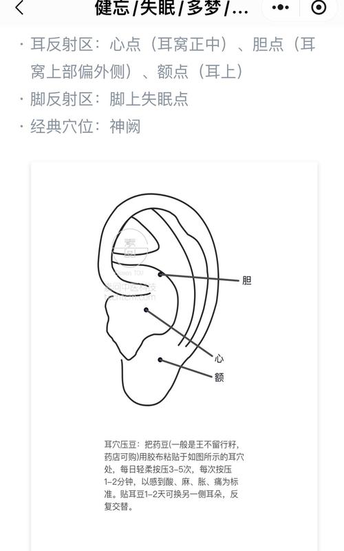 睡眠不好耳针哪些穴位