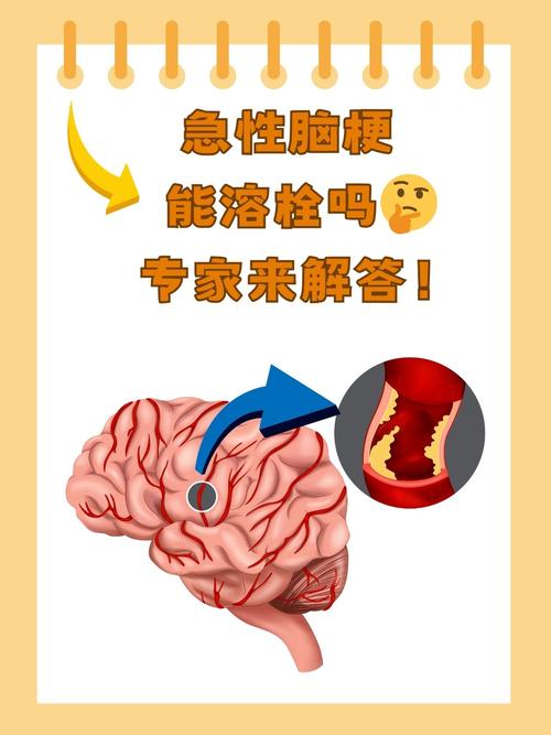 脑血栓和脑梗是一种病吗