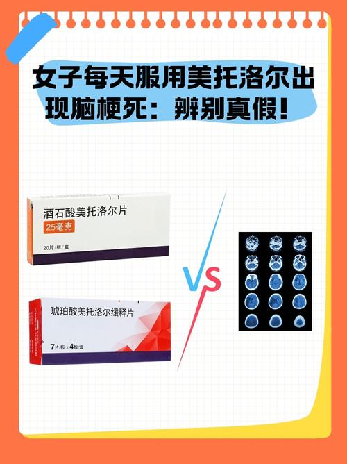 脑梗后遗症常用药一览表