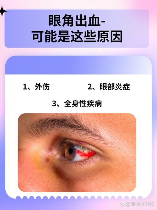 眼底出血和脑梗有关系吗