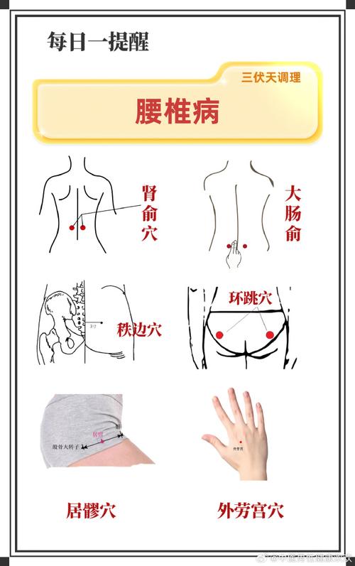 治疗腰椎滑脱针灸穴位