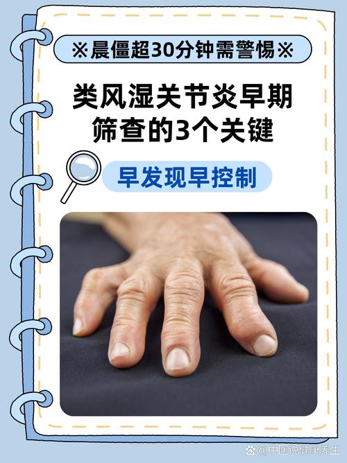 风湿 类风湿做什么检查