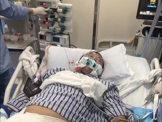 脑梗开颅手术进ICU