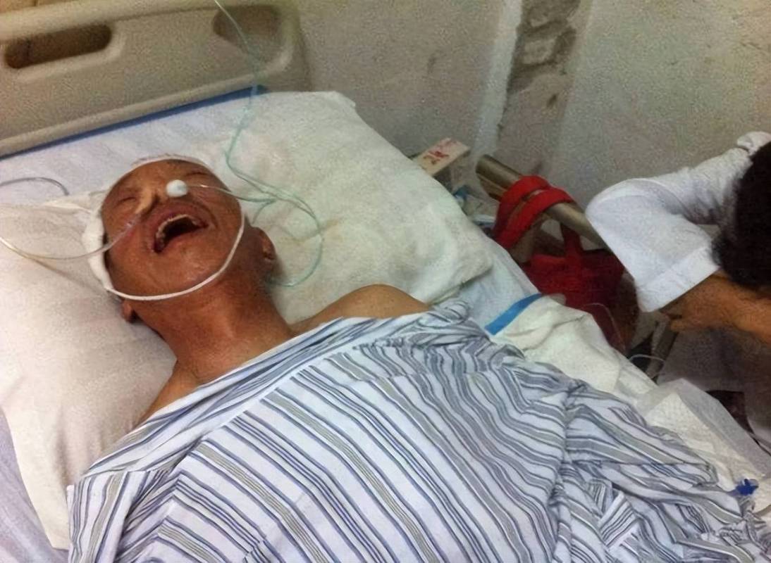 轻度脑梗导致半身瘫痪