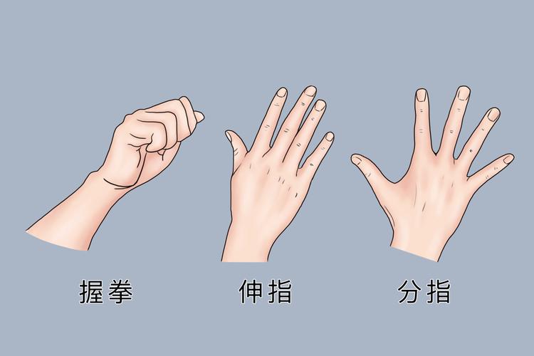 脑梗患者手指精细动作