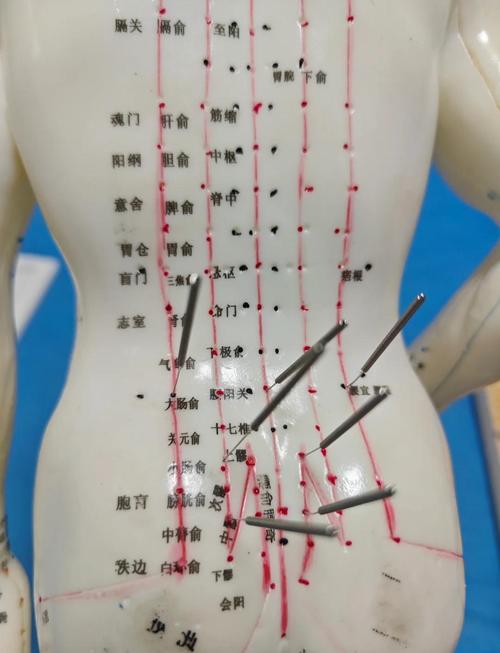 腰肌劳损拉伤推拿穴位